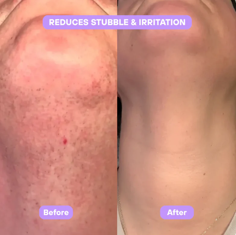 Cyperus Rotundus Skin Serum - Image 4