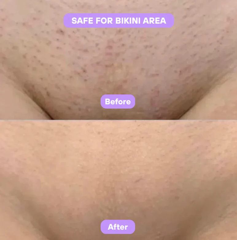 Cyperus Rotundus Skin Serum - Image 5