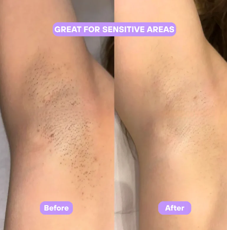 Cyperus Rotundus Skin Serum - Image 6