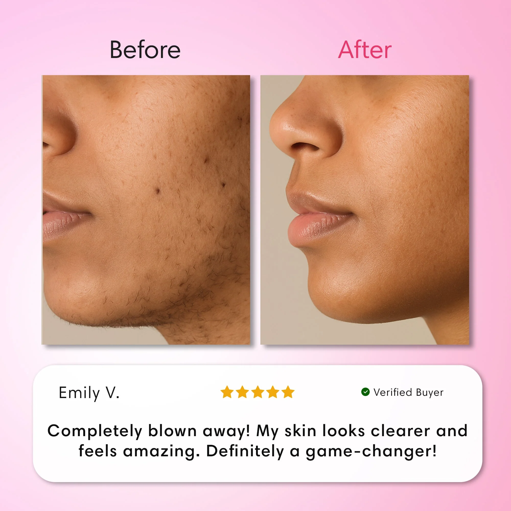 Hair Removal Trilogy Kit - Image 2