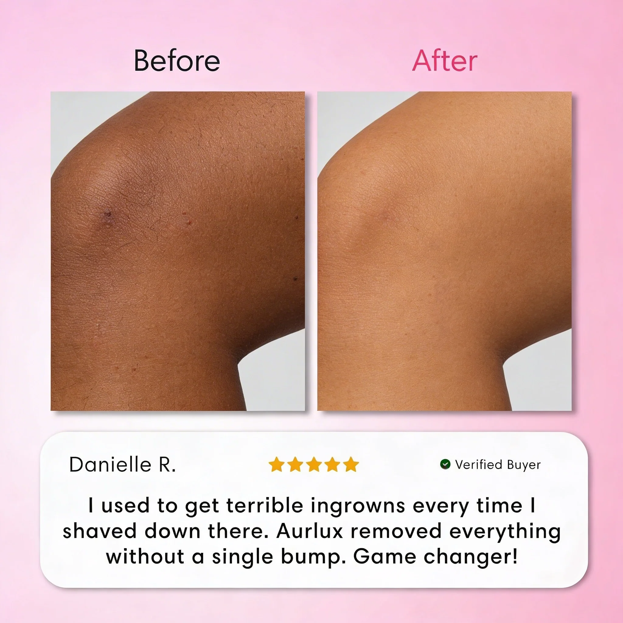 Intimate Hair Removal Kit - Image 7