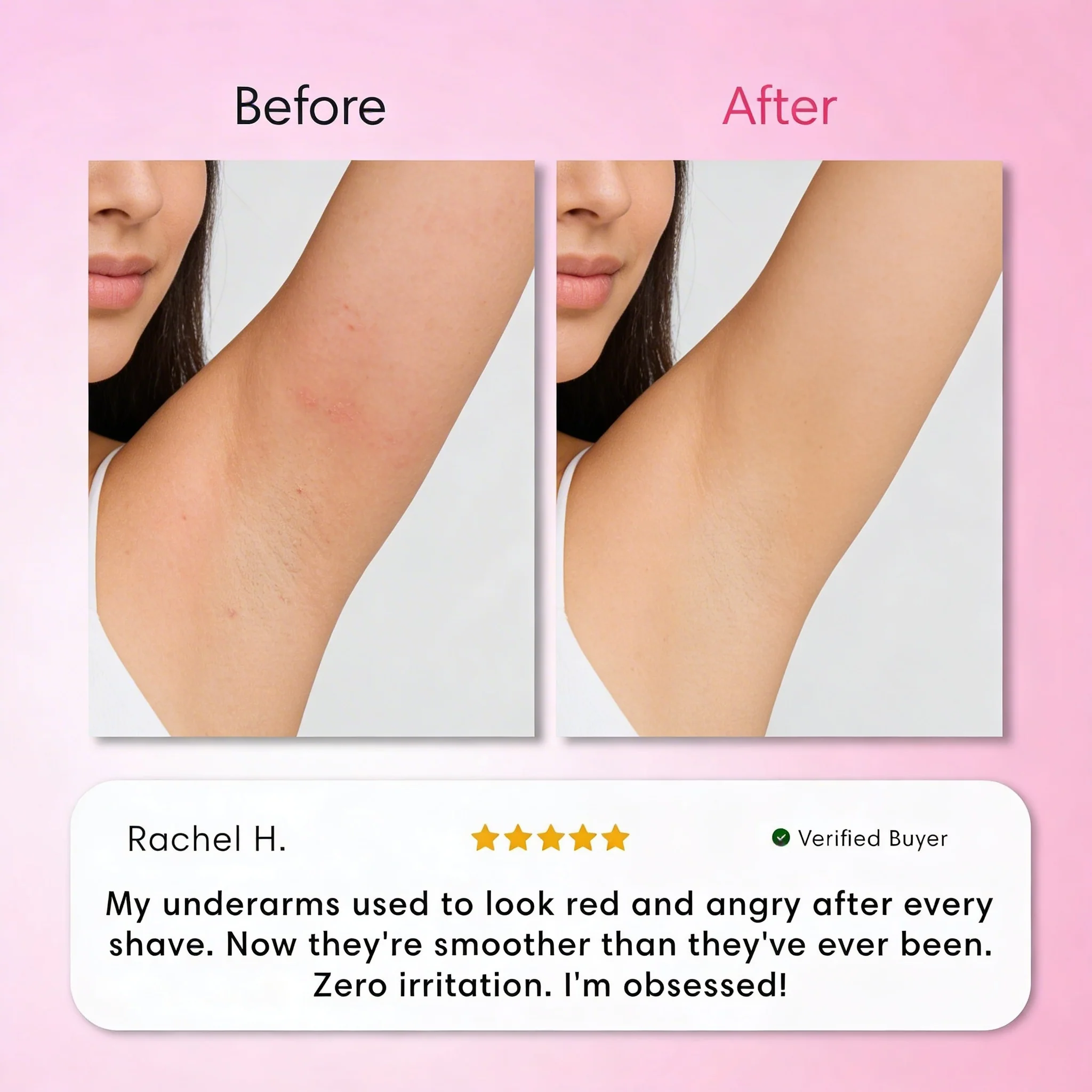 Intimate Hair Removal Kit - Image 8