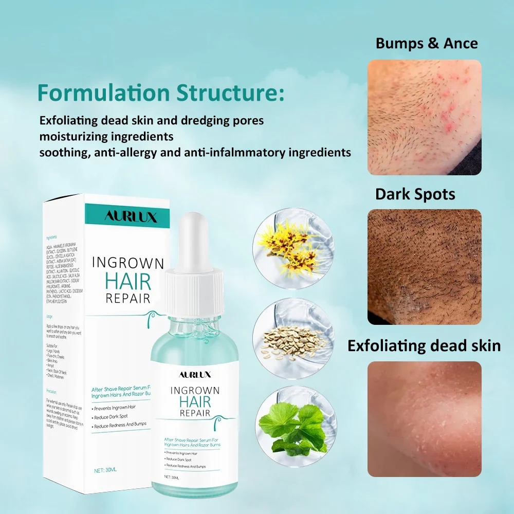 Ingrown Hair Repair Serum - Image 3