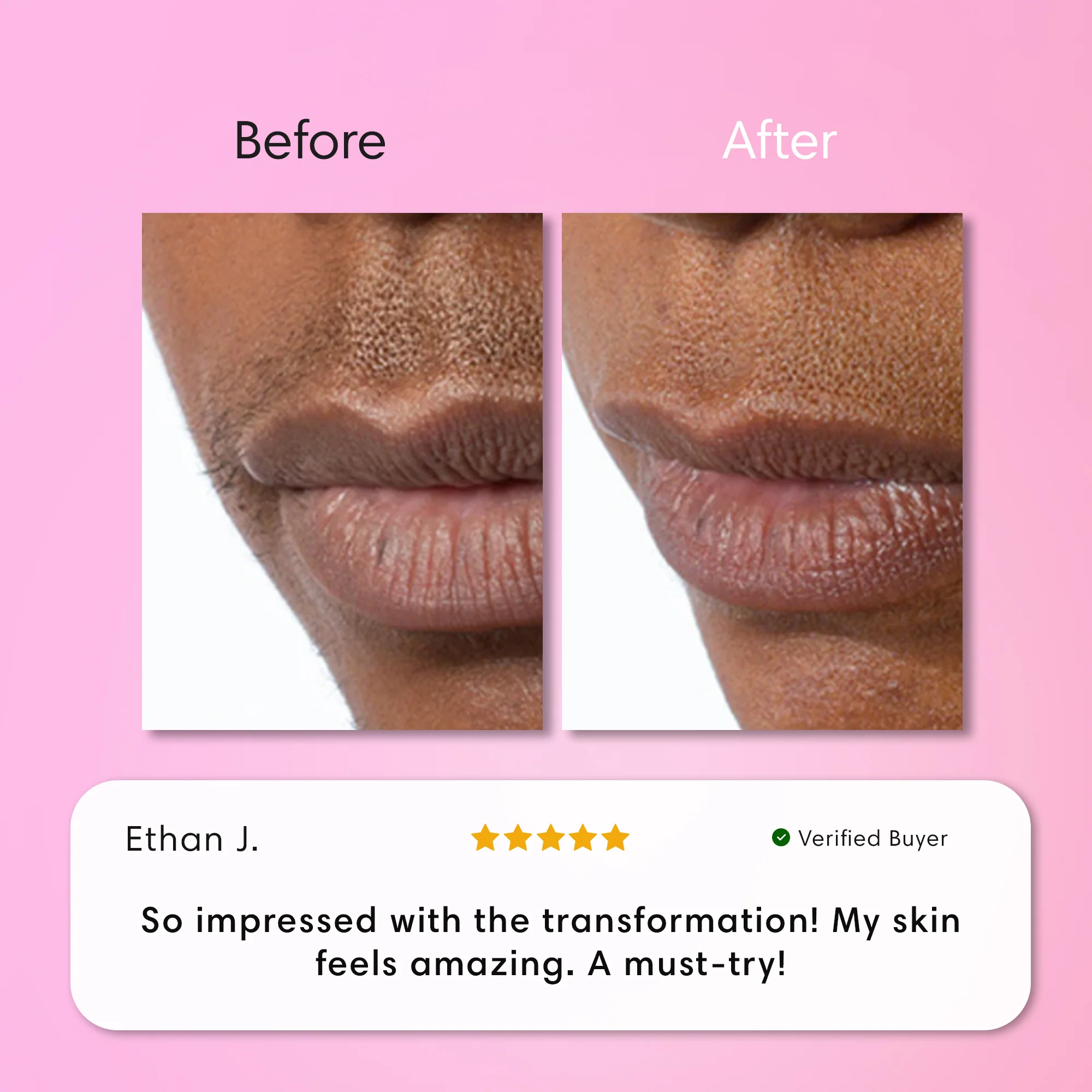 Instant Hair Removal Kit - Image 11
