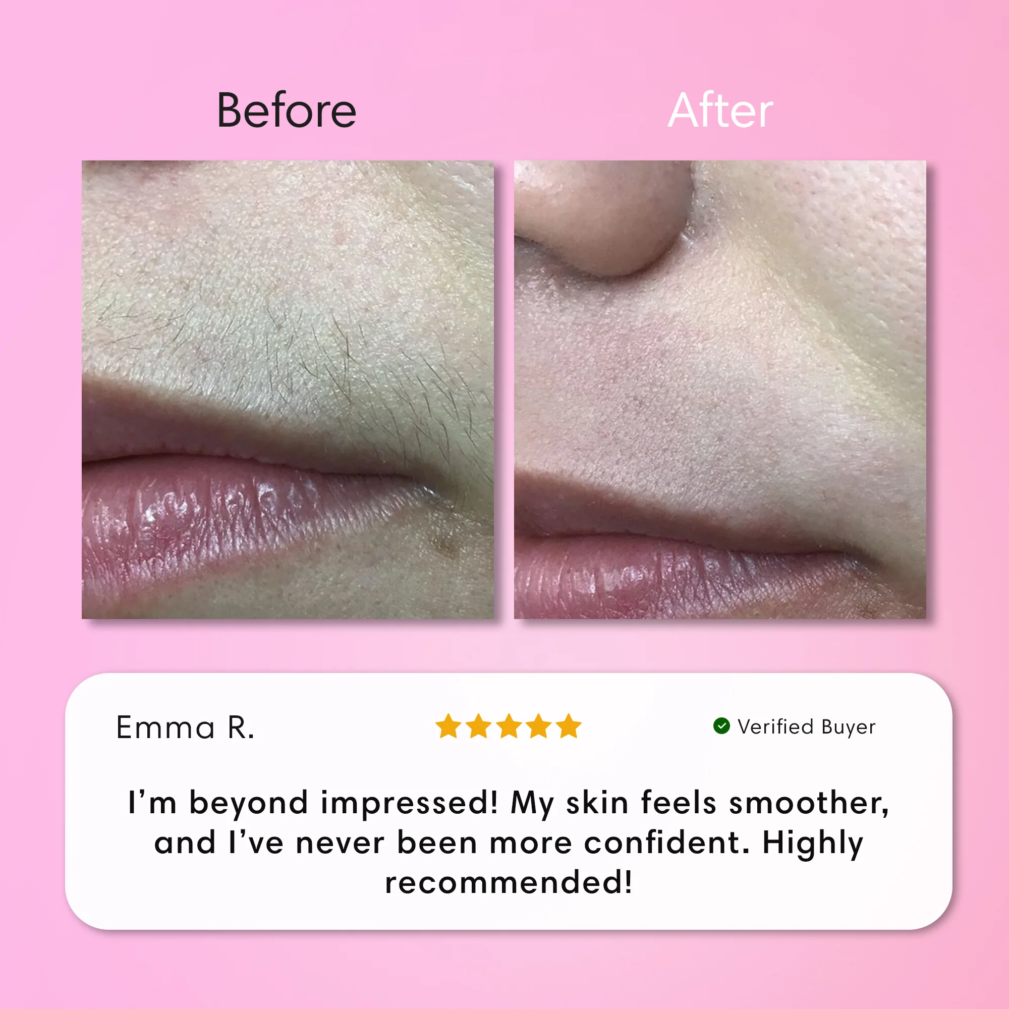 Instant Hair Removal Kit - Image 12