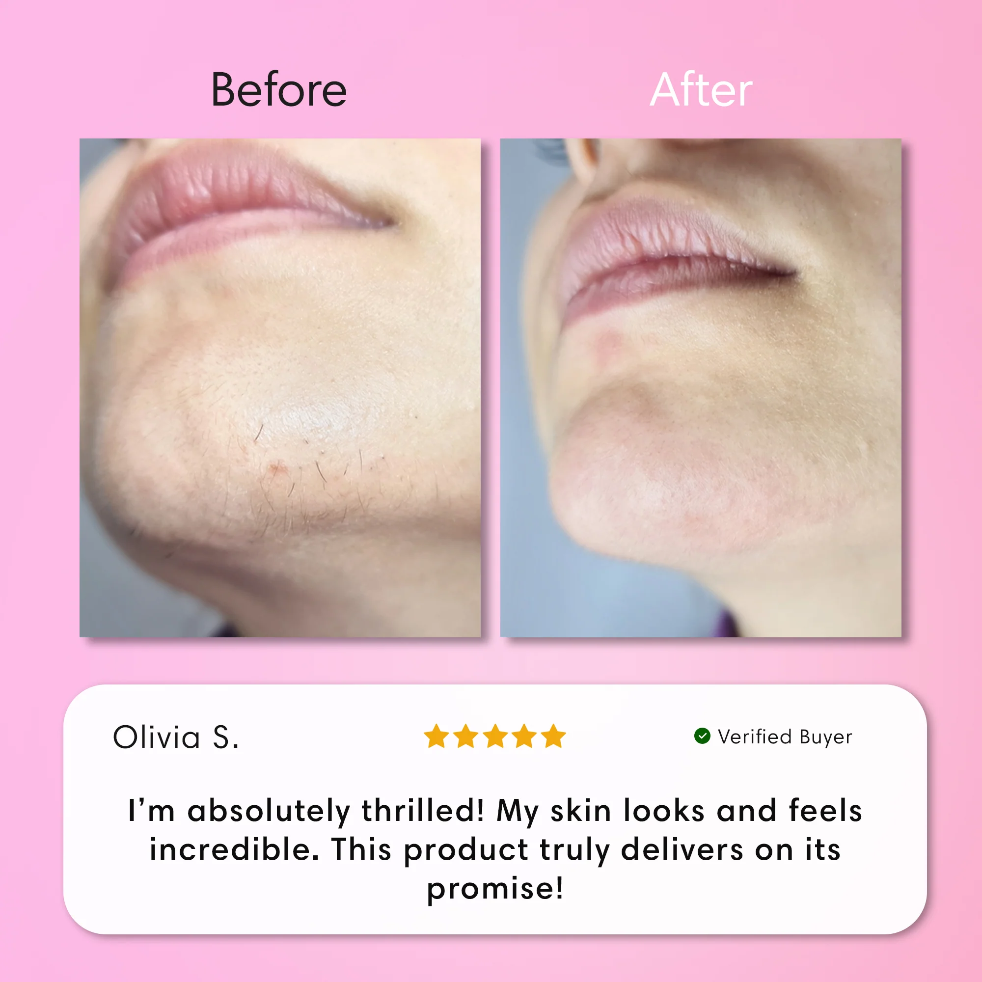 Instant Hair Removal Kit - Image 13