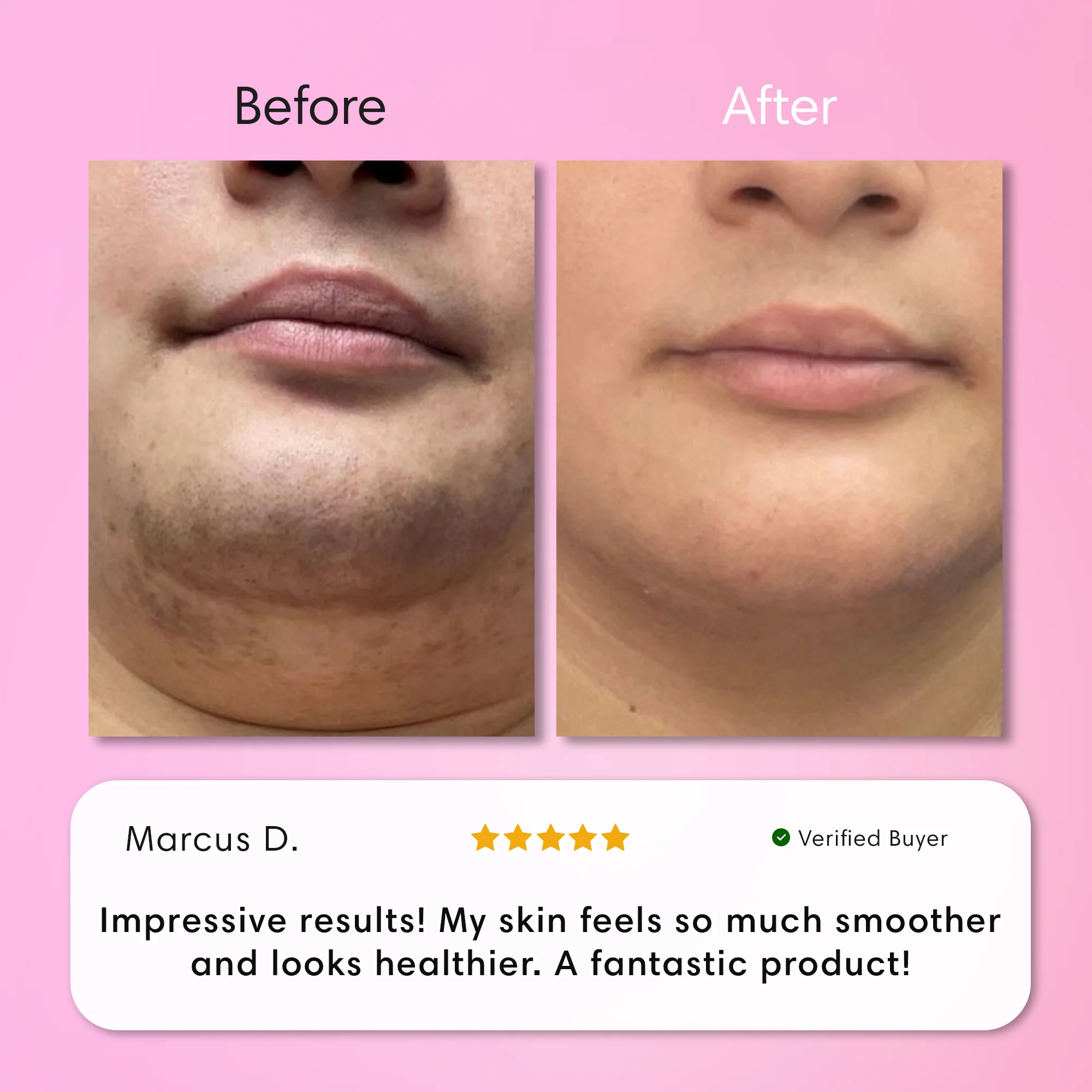 Instant Hair Removal Kit - Image 3