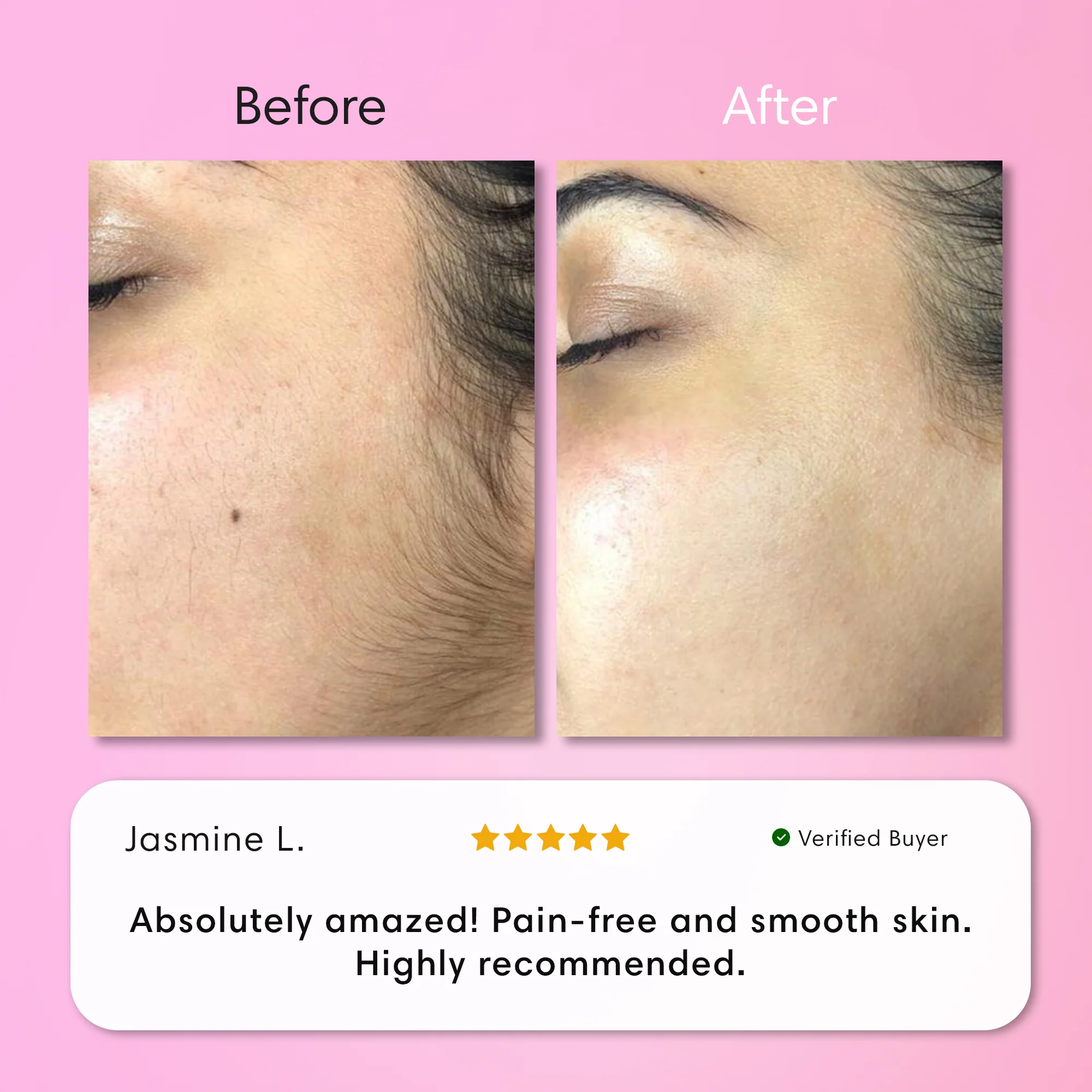 Instant Hair Removal Kit - Image 10