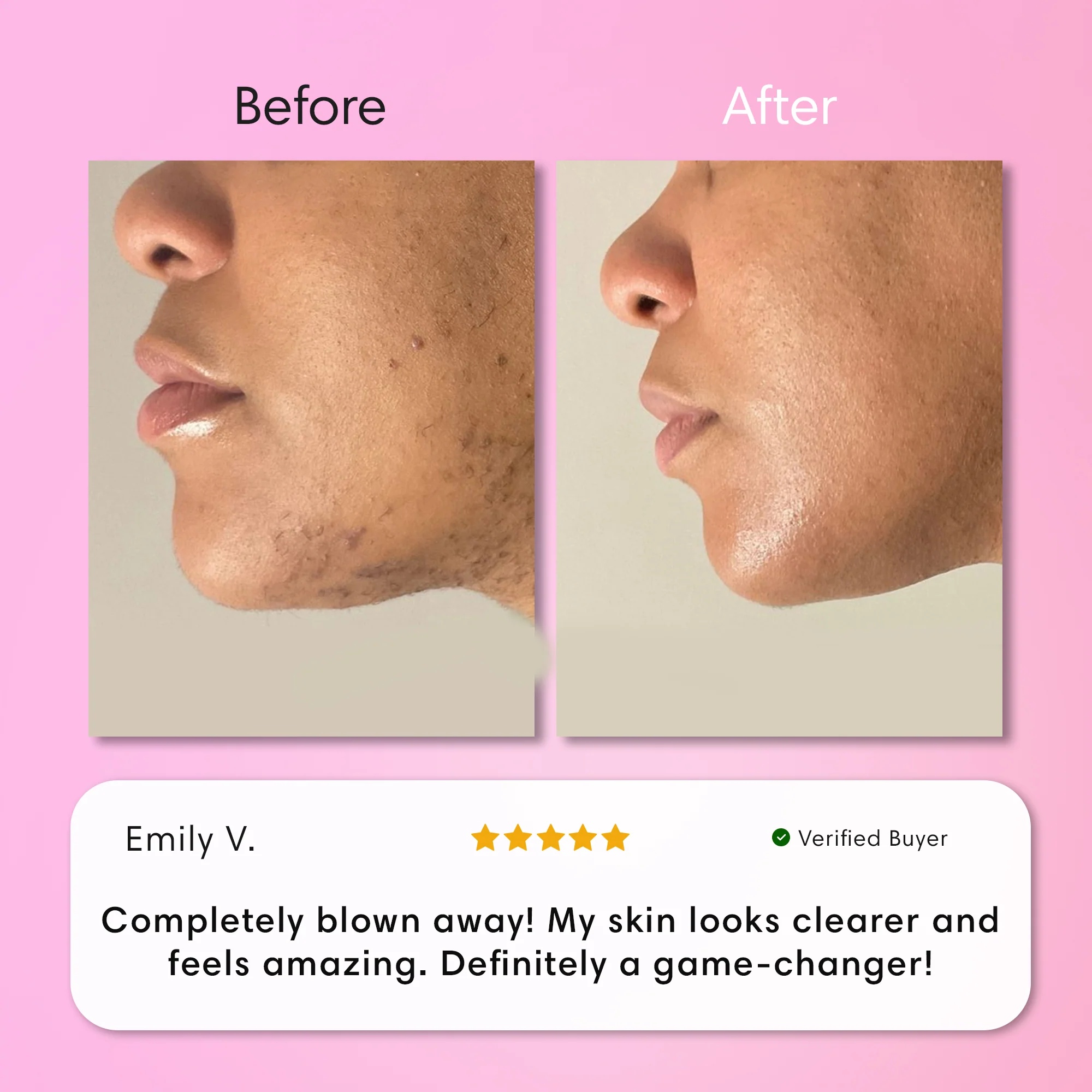 Instant Hair Removal Kit - Image 6
