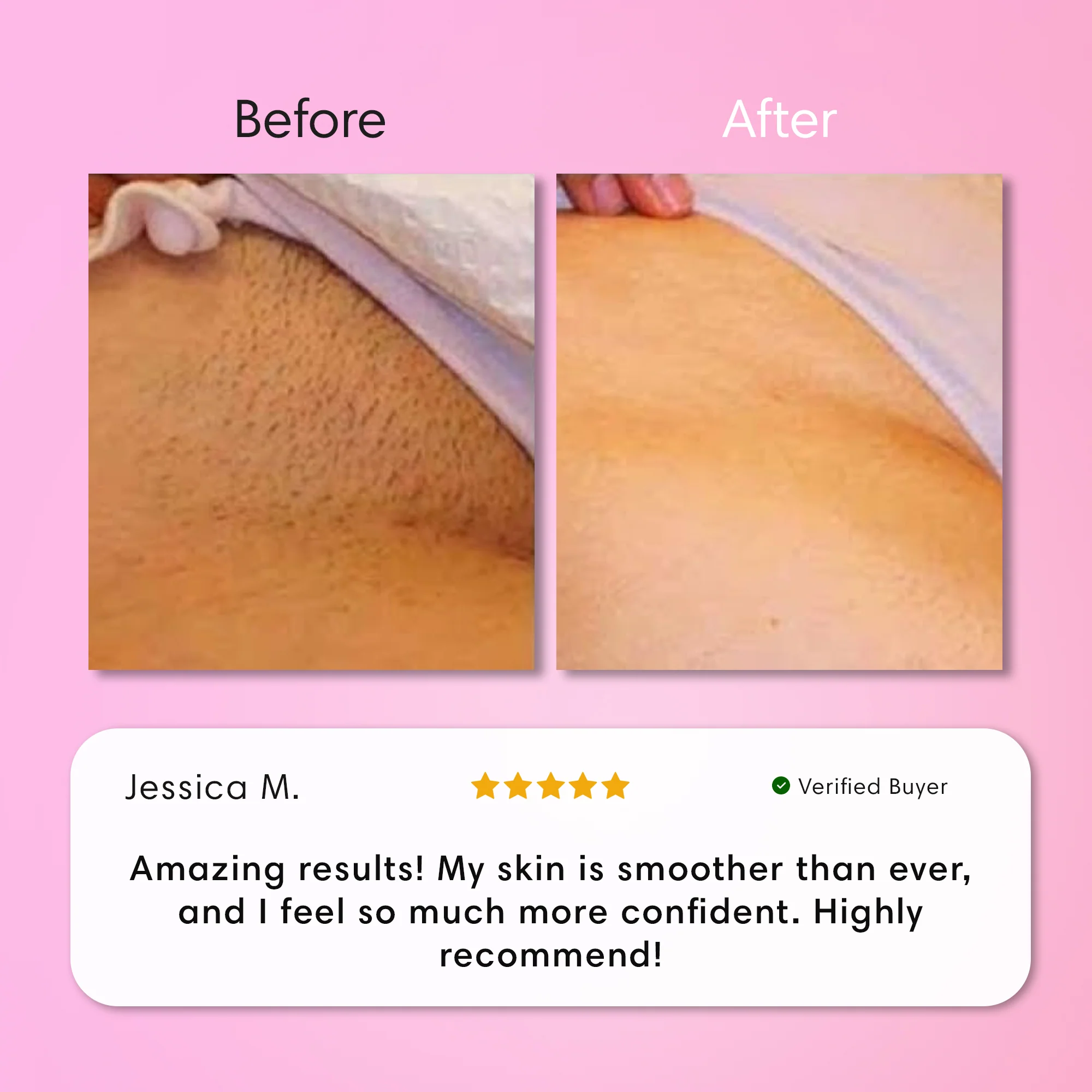 Painless Body Hair Removal Cream - Image 9