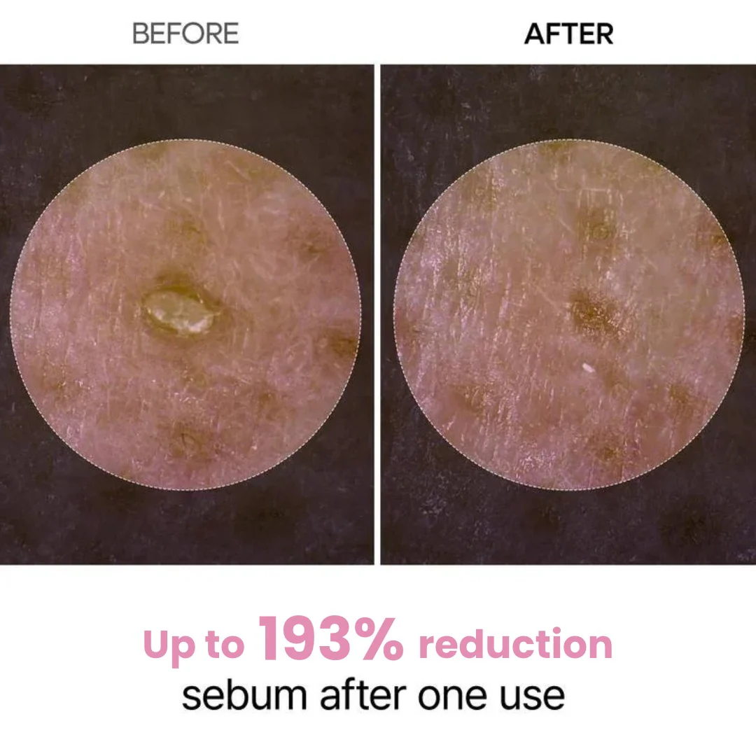 Peel Shot Glow Rice Ampoule Duo by Aurlux - Image 3