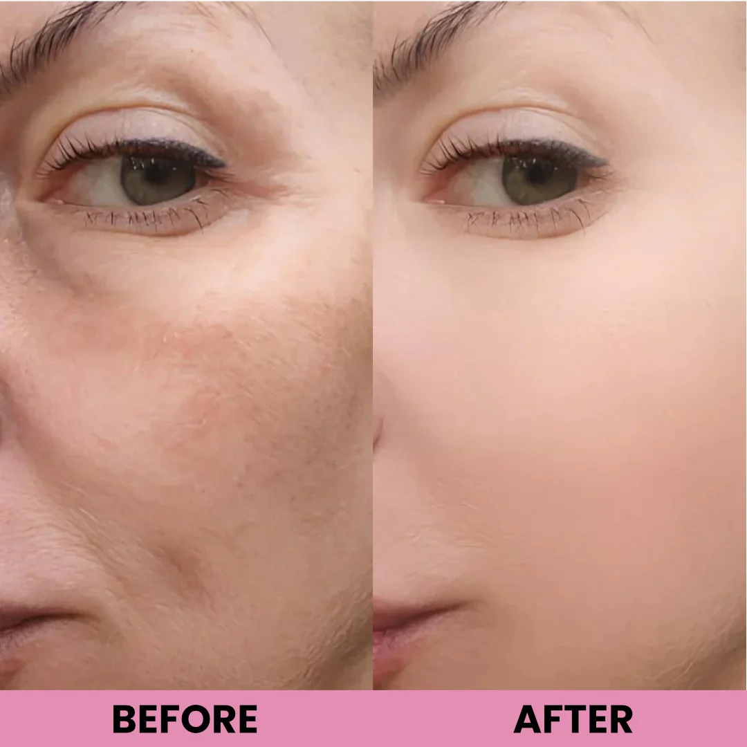 Peel Shot Glow Rice Ampoule Duo by Aurlux - Image 5